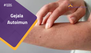 Read more about the article Gejala Autoimun