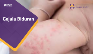 Read more about the article Gejala Biduran