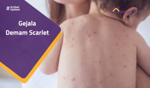 Read more about the article Gejala Demam Scarlet