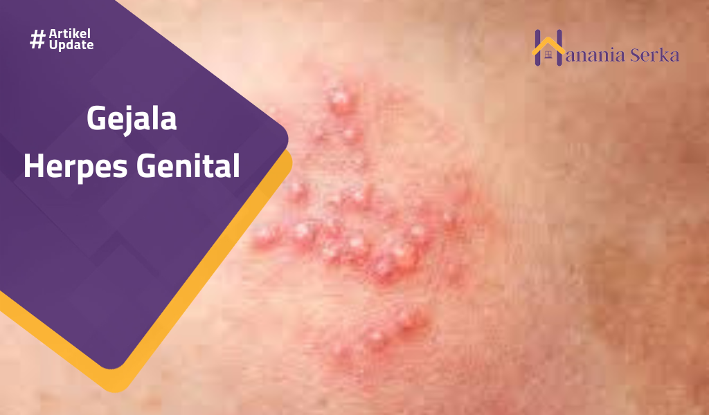 Read more about the article Gejala Herpes Genital