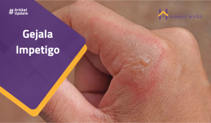Read more about the article Gejala Impetigo
