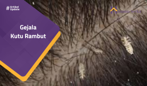 Read more about the article Gejala Kutu Rambut