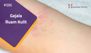 Read more about the article Gejala Ruam Kulit