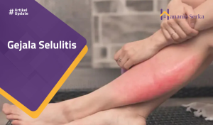 Read more about the article Gejala Selulitis