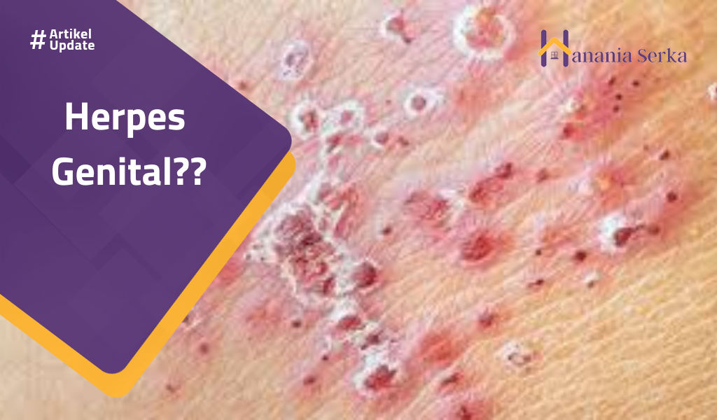 Read more about the article Herpes Genital??