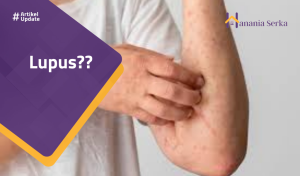 Read more about the article Lupus??