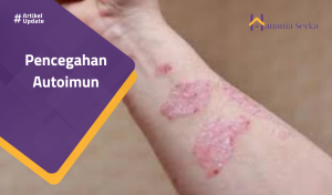 Read more about the article Pencegahan Autoimun