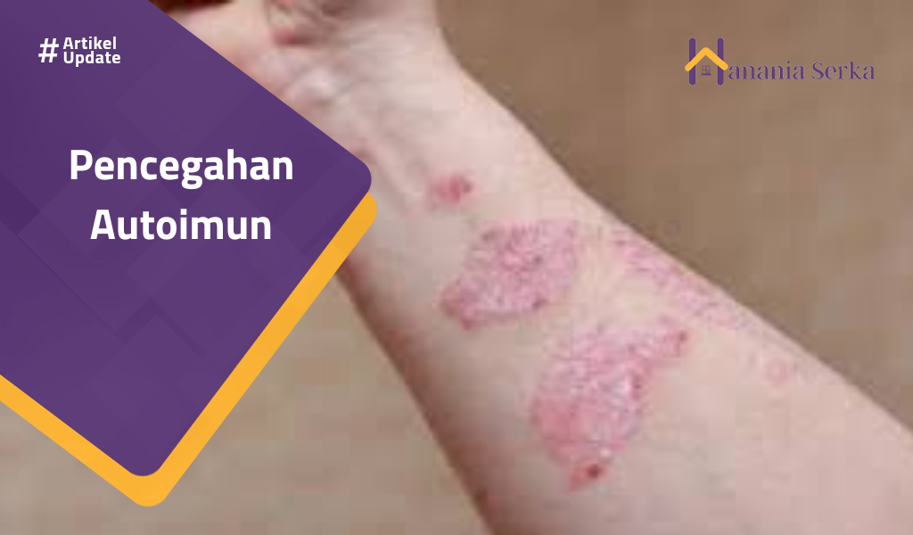 You are currently viewing Pencegahan Autoimun