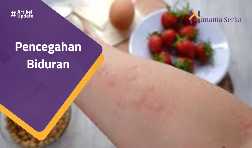 You are currently viewing Pencegahan Biduran