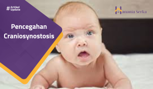 Read more about the article Pencegahan Craniosynostasis