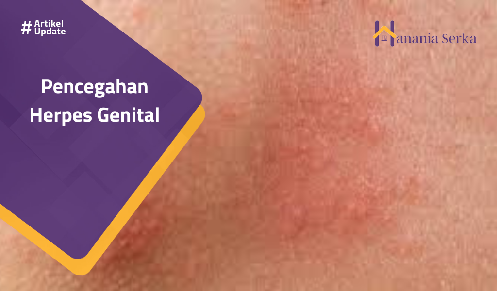 You are currently viewing Pencegahan Herpes Genital