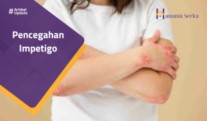 Read more about the article Pencegahan Impetigo