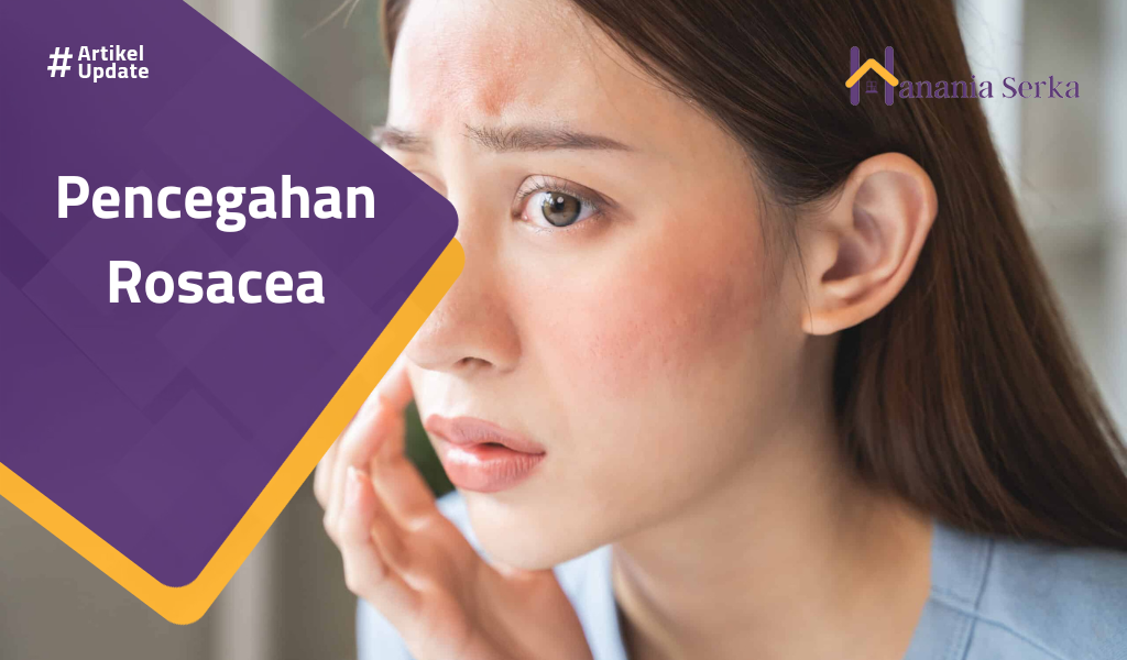 Read more about the article Pencegahan Rosacea