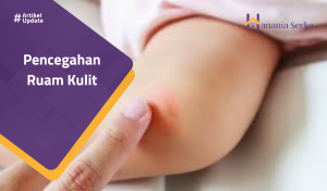Read more about the article Pencegahan Ruam Kulit