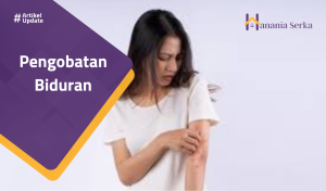 Read more about the article Pengobatan Biduran