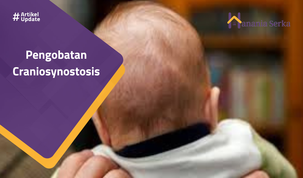 Read more about the article Pengobatan Craniosynostasis