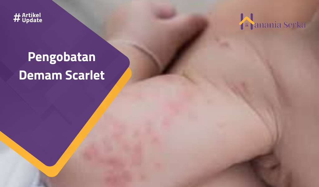 You are currently viewing Pengobatan Demam Scarlet