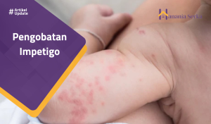 Read more about the article Pengobatan Impetigo