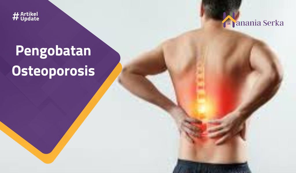 Read more about the article Pengobatan Osteoporosis