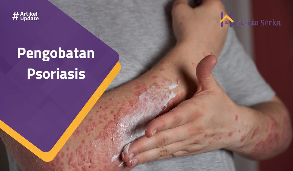 Read more about the article Pengobatan Psoriasis