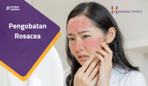 Read more about the article Pengobatan Rosacea