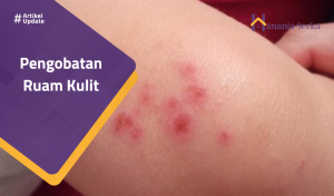 Read more about the article Pengobatan Ruam Kulit