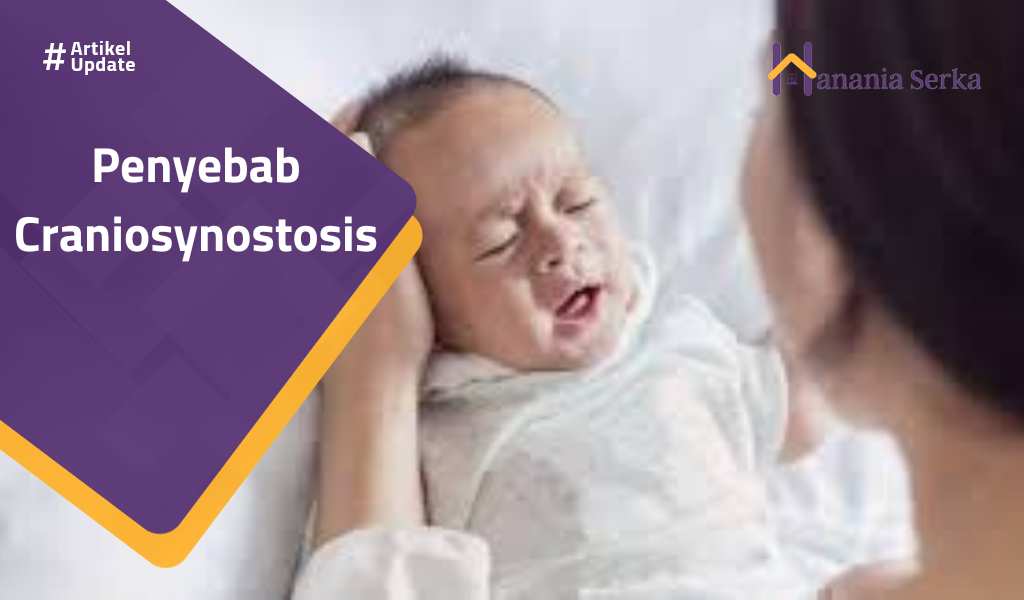 Read more about the article Penyebab Craniosynostasis