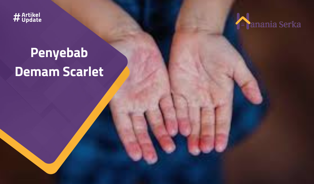 Read more about the article Penyebab Demam Scarlet