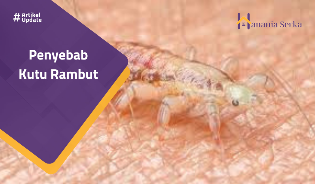 You are currently viewing Penyebab Kutu Rambut