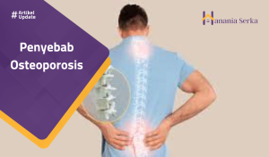 Read more about the article Penyebab Osteoporosis