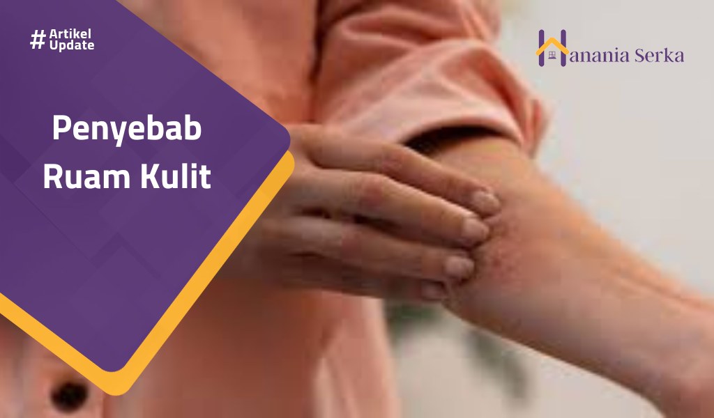 Read more about the article Penyebab Ruam Kulit
