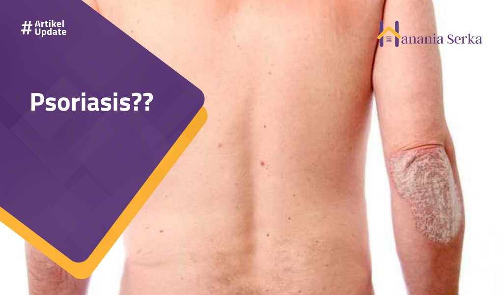 Read more about the article Psoriasis??