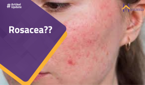 Read more about the article Rosacea??