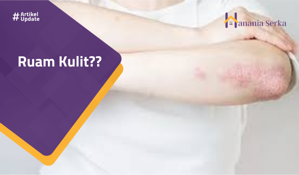 Read more about the article Ruam Kulit??