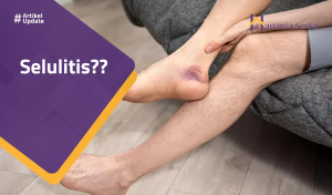 Read more about the article Selulitis??