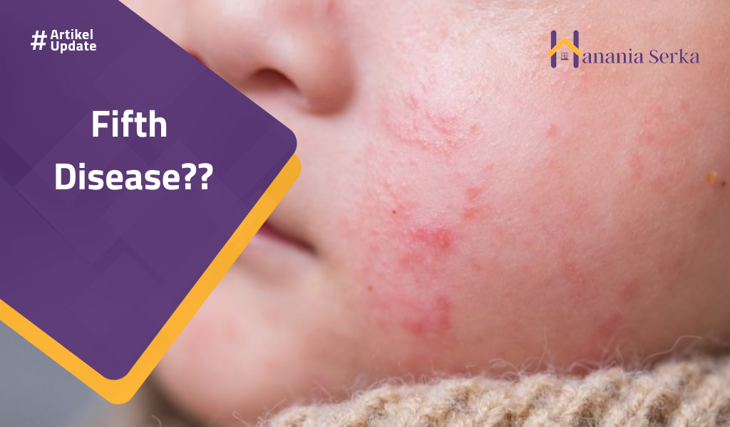Read more about the article Fifth Disease??