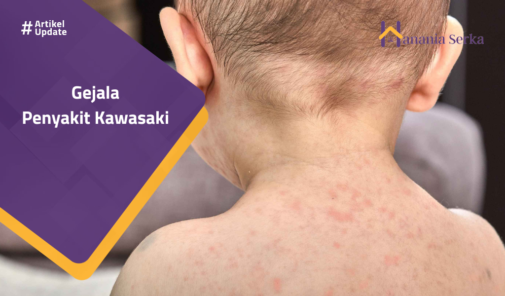 You are currently viewing Gejala Penyakit Kawasaki