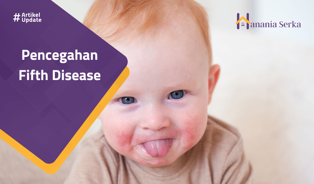 You are currently viewing Pencegahan Fifth Disease