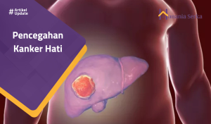 Read more about the article Pencegahan Kanker Hati