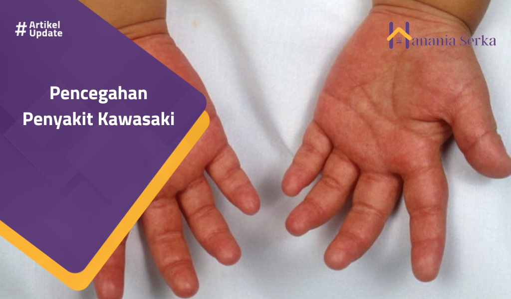 Read more about the article Pencegahan Penyakit Kawasaki