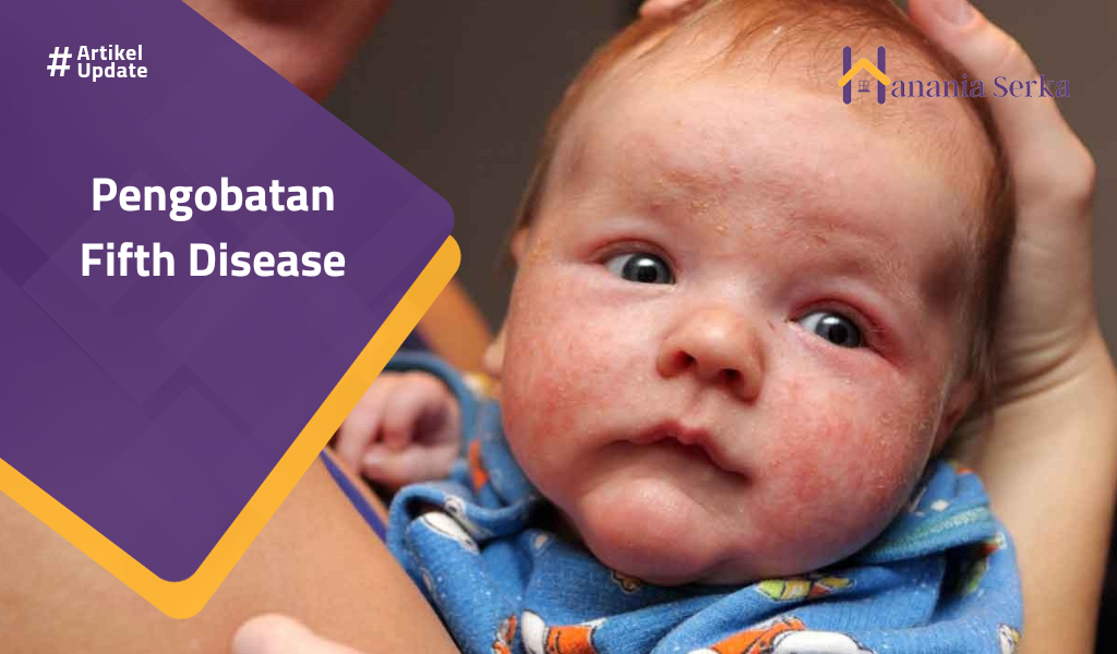 You are currently viewing Pengobatan Fifth Disease