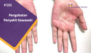 Read more about the article Pengobatan Penyakit Kawasaki