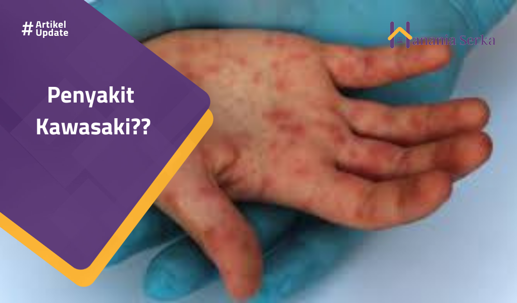 Read more about the article Penyakit Kawasaki??