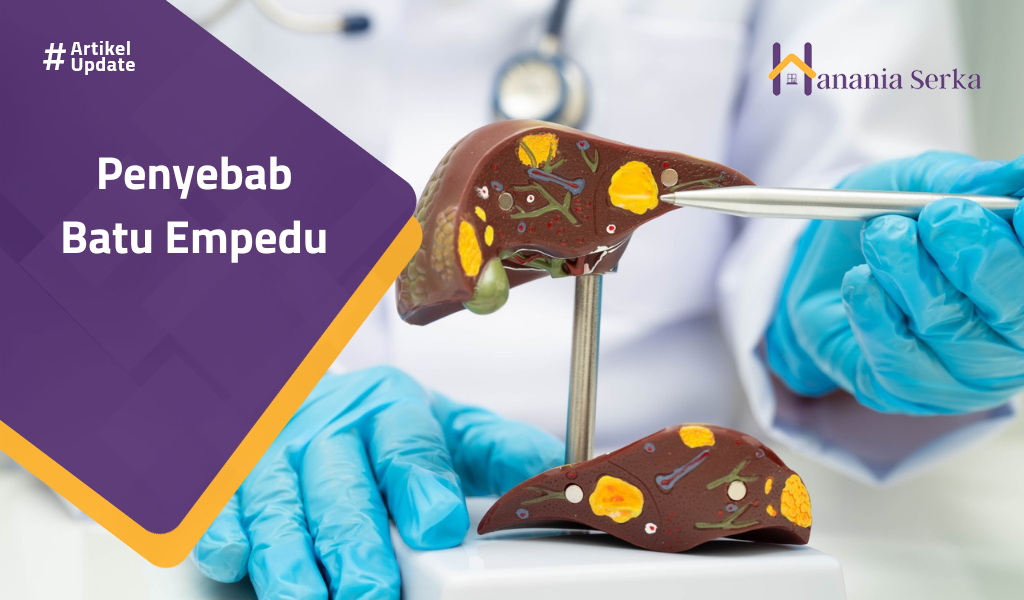 Read more about the article Penyebab Batu Empedu