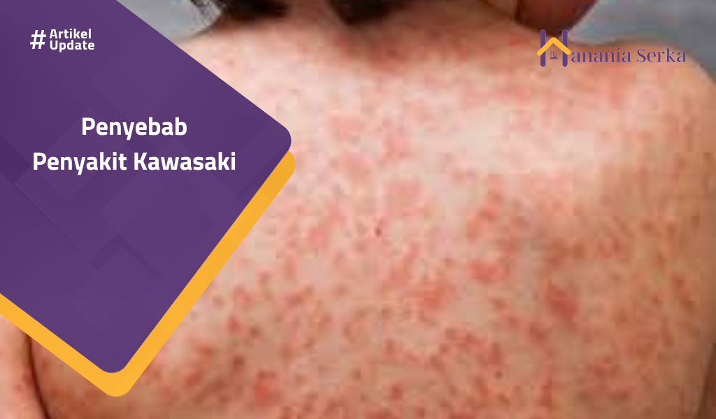 Read more about the article Penyebab Penyakit Kawasaki