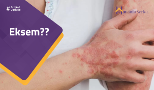 Read more about the article Eksem??