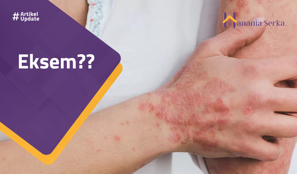 You are currently viewing Eksem??