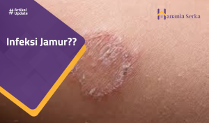 Read more about the article Infeksi Jamur??