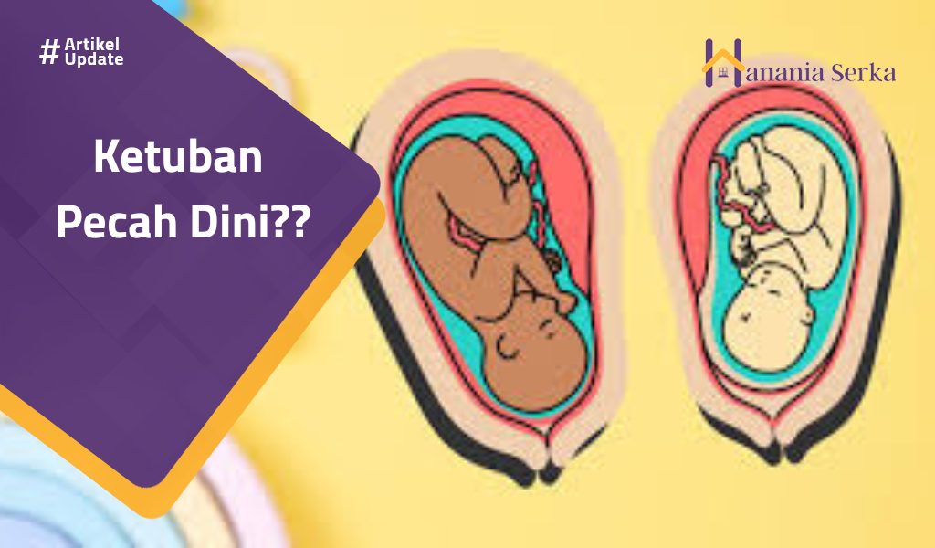 You are currently viewing Ketuban Pecah Dini??