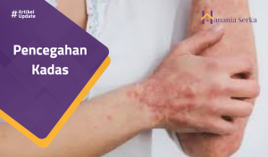 Read more about the article Pencegahan Kadas